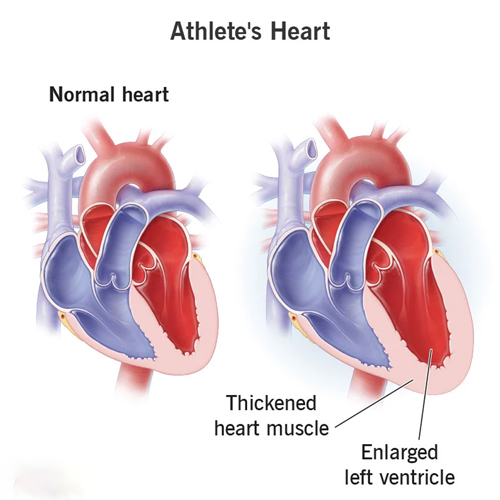 Soccer Player Cardiovascular Health and Endurance